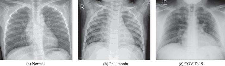 /Portfolio/covid19-detection-cnns/xrays.jpg /Portfolio/covid19-detection-cnns/xrays.jpg